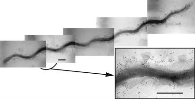 Approaches to Understanding Mechanisms of Dentilisin Protease Complex Expression in Treponema denticola